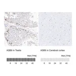 Atlas Antibodies Anti-ASB9 Antibody