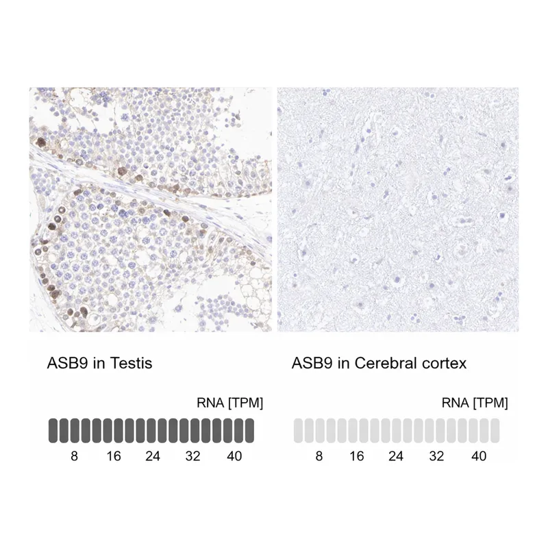 Atlas Antibodies Anti-ASB9 Antibody