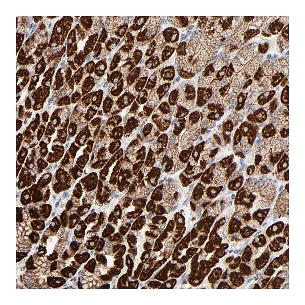 Atlas Antibodies Anti-ASB3 Antibody