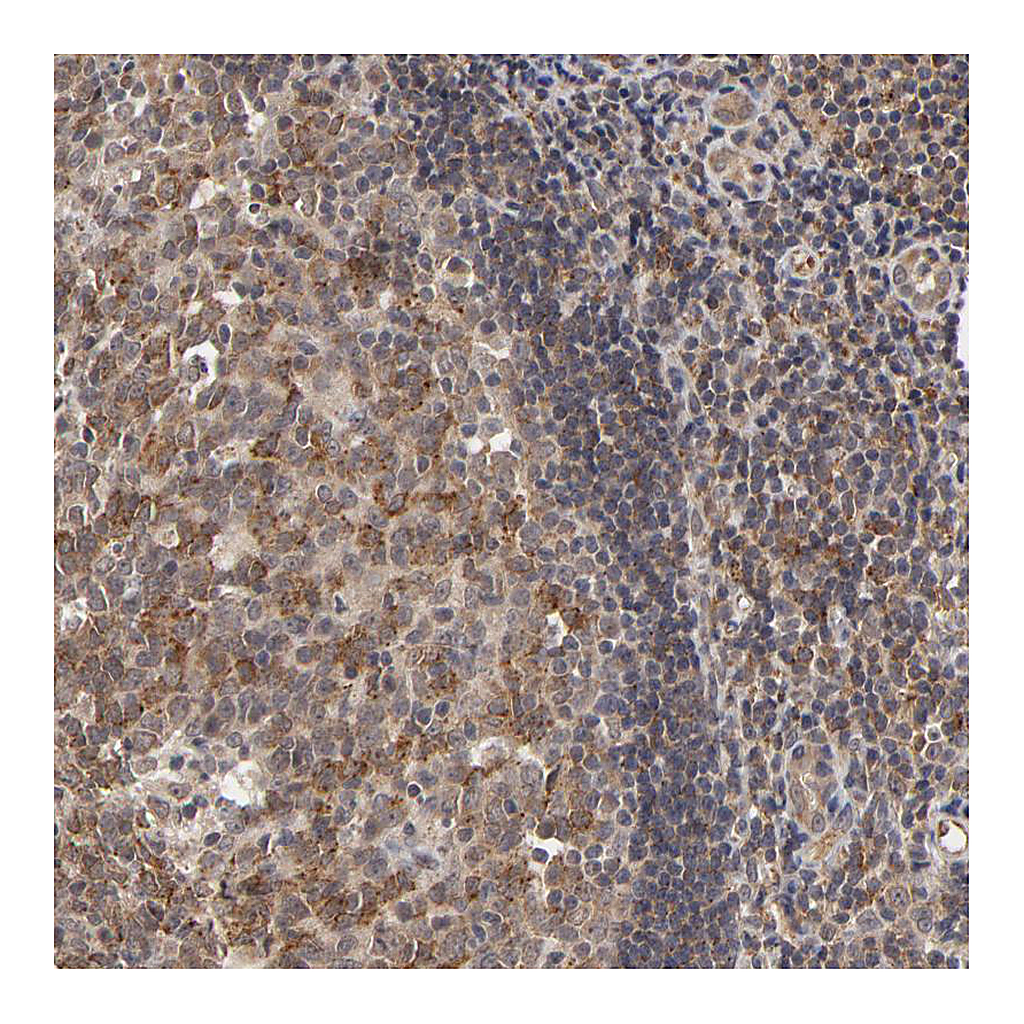 Atlas Antibodies Anti-ASB8 Antibody