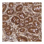 Atlas Antibodies Anti-ASCC2 Antibody