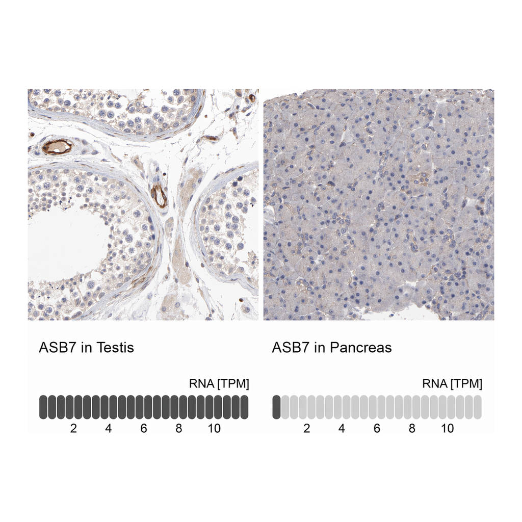 Atlas Antibodies Anti-ASB7 Antibody