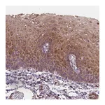 Atlas Antibodies Anti-ASB18 Antibody