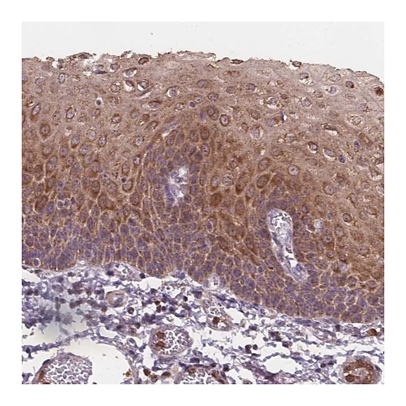 Atlas Antibodies Anti-ASB18 Antibody