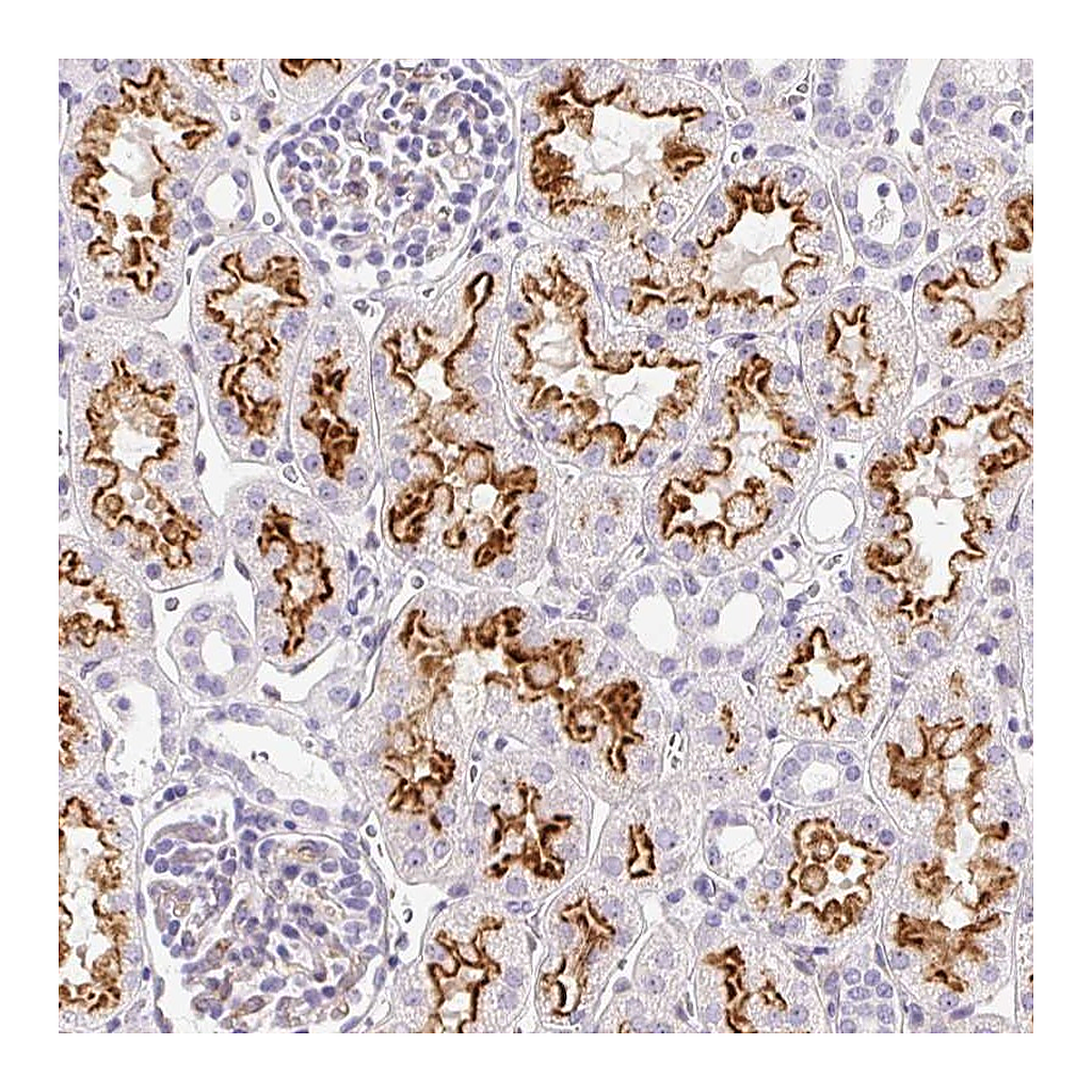 Atlas Antibodies Anti-ASB4 Antibody