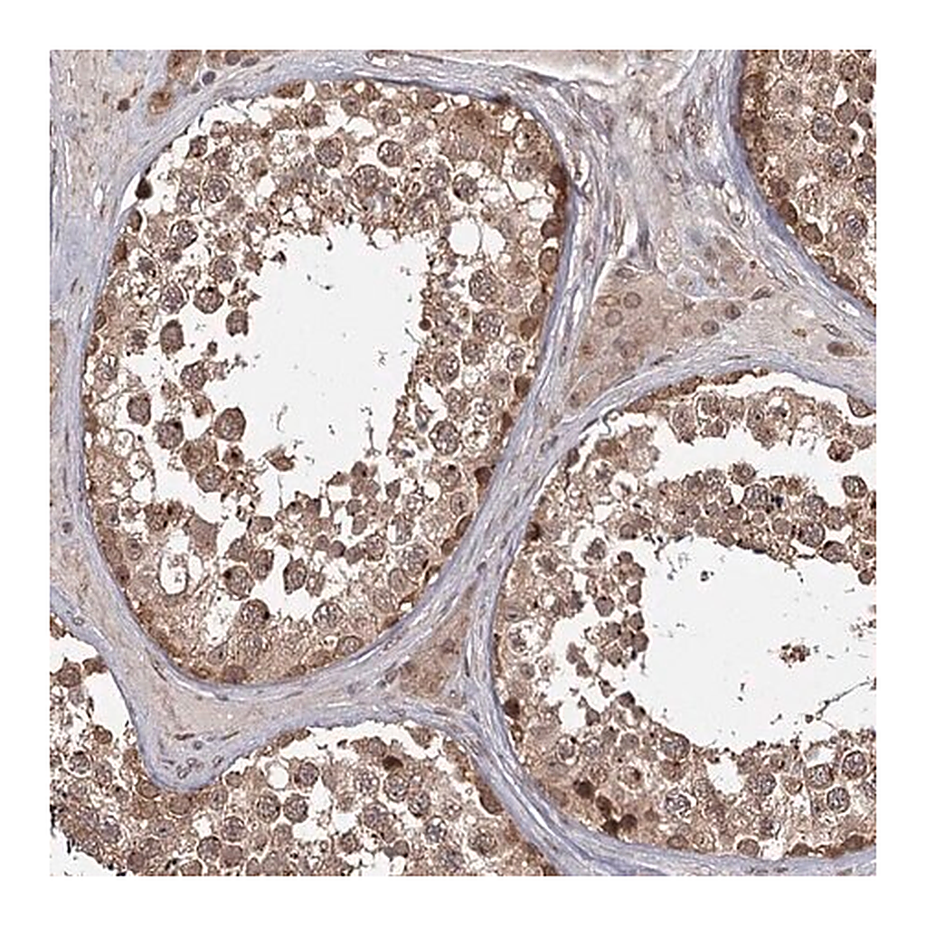 Merck Anti-TBC1D23 antibody produced in rabbit