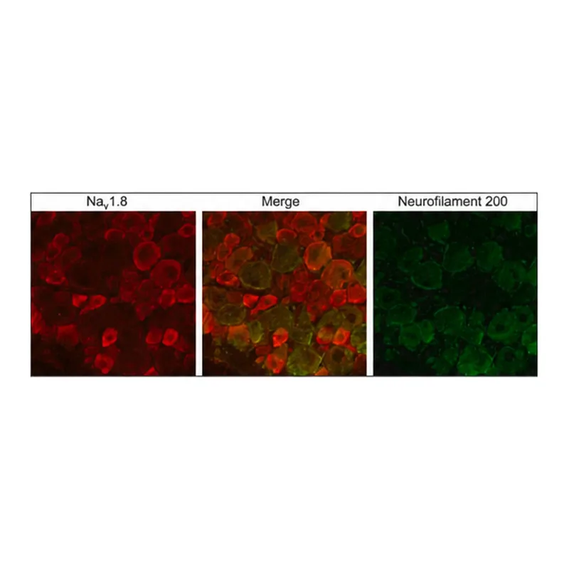 Merck Anti-Sodium Channel NaV1.8 antibody produced in rabbit