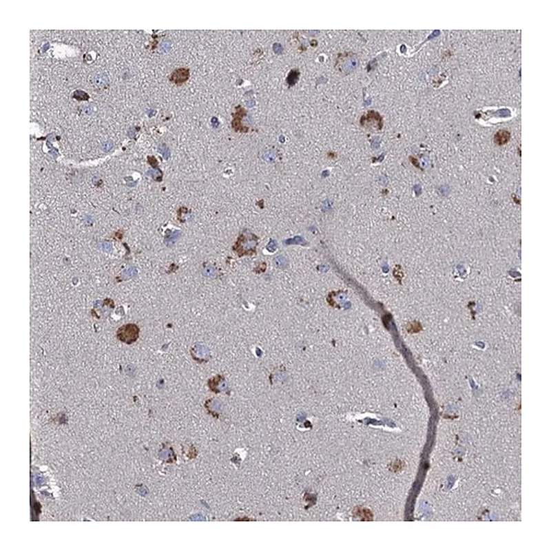 Merck Anti-TMX2 antibody produced in rabbit
