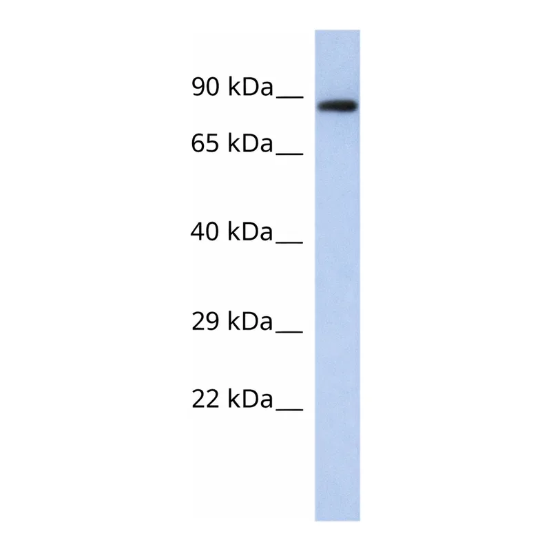 Merck Anti-ZFYVE20, (N-terminal) antibody produced in rabbit