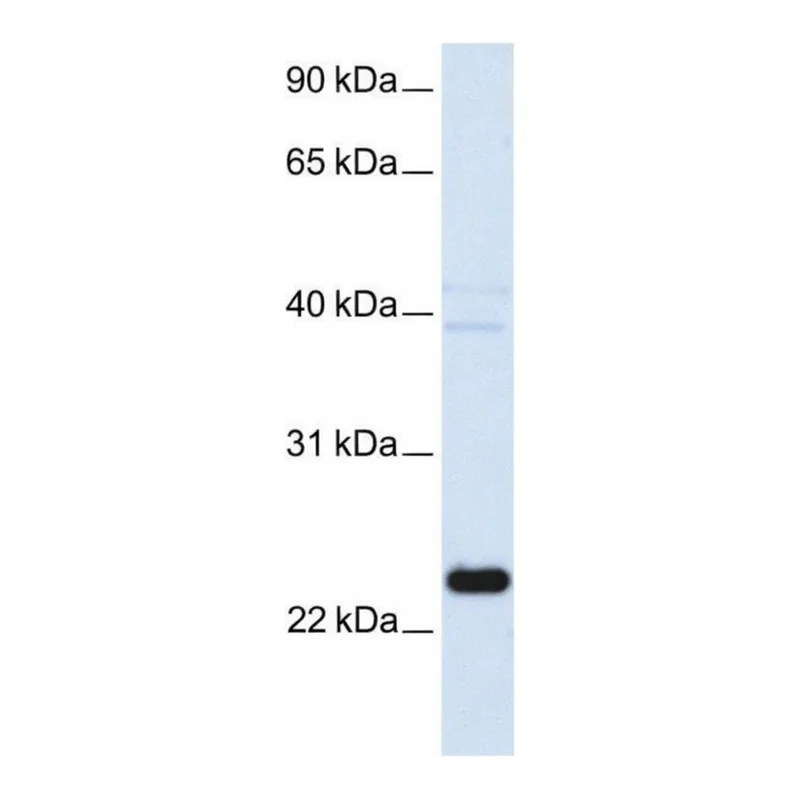 Merck Anti-HSPB8 antibody produced in rabbit