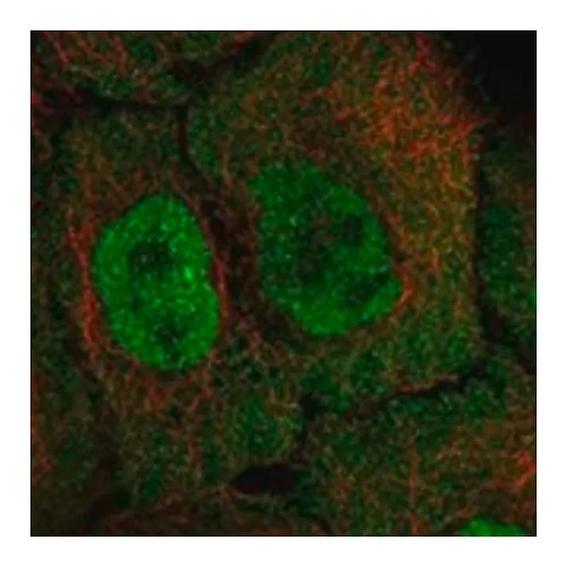 Merck Anti-ADK antibody produced in rabbit