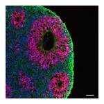 Thermo Fisher Scientific Donkey anti-Mouse IgG (H+L) ReadyProbes Secondary Antibody, Alexa Fluor 488