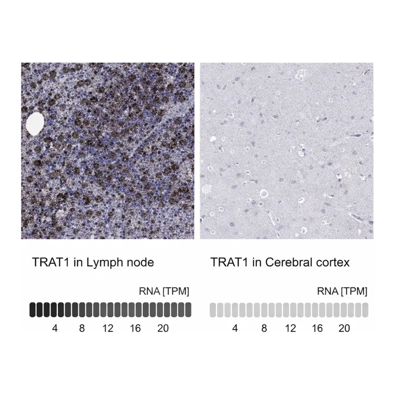 Merck Anti-TRAT1 antibody produced in rabbit