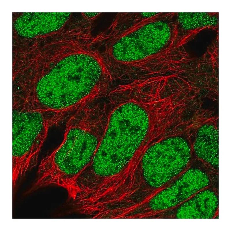 Merck Anti-RBX1 antibody produced in rabbit