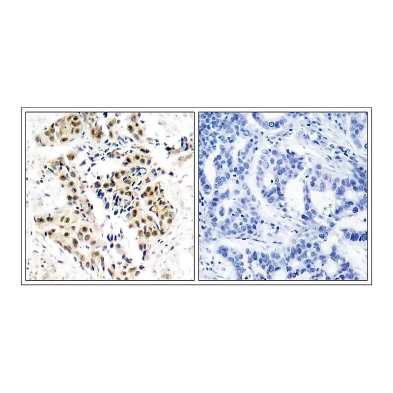 Merck Anti-phospho-ATM (pSer1981) antibody produced in rabbit