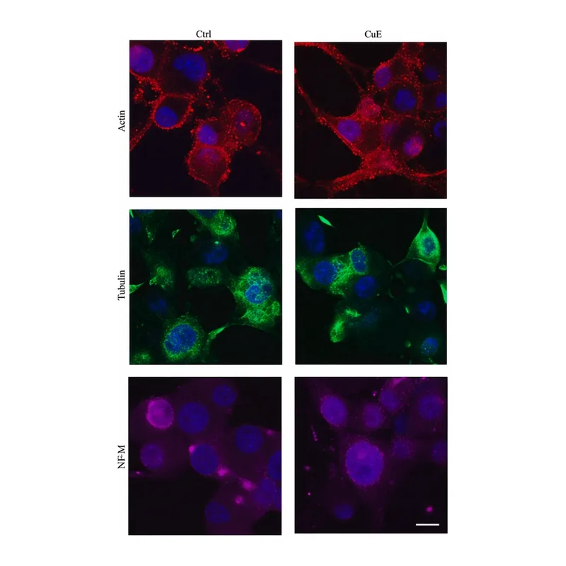 Merck Monoclonal Anti-Neurofilament 160 antibody produced in mouse
