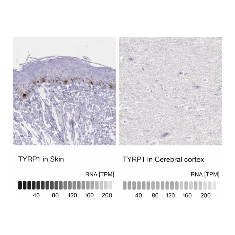 Merck Anti-TYRP1 antibody produced in rabbit