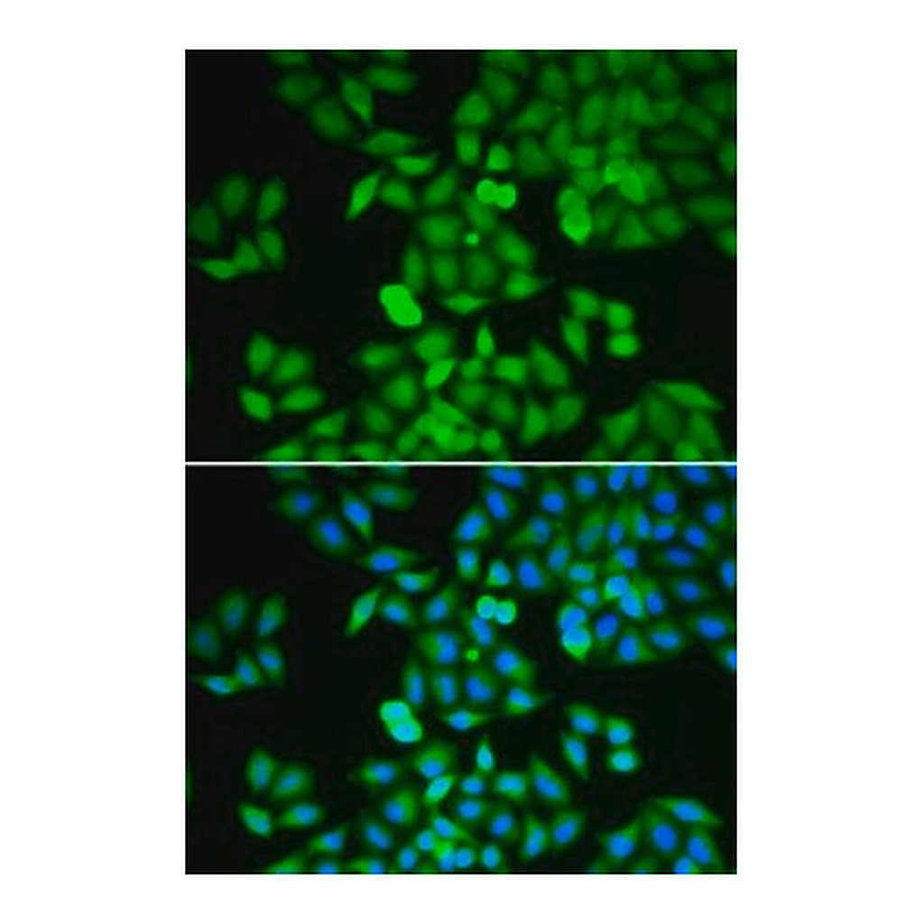Merck Anti- RhoGDI antibody produced in rabbit