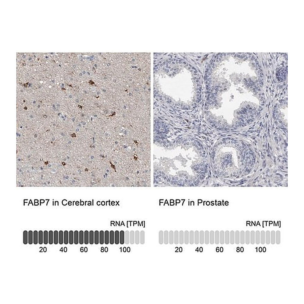 Merck Anti-FABP7 antibody produced in rabbit