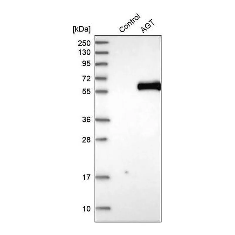 Merck Anti-AGT antibody produced in rabbit