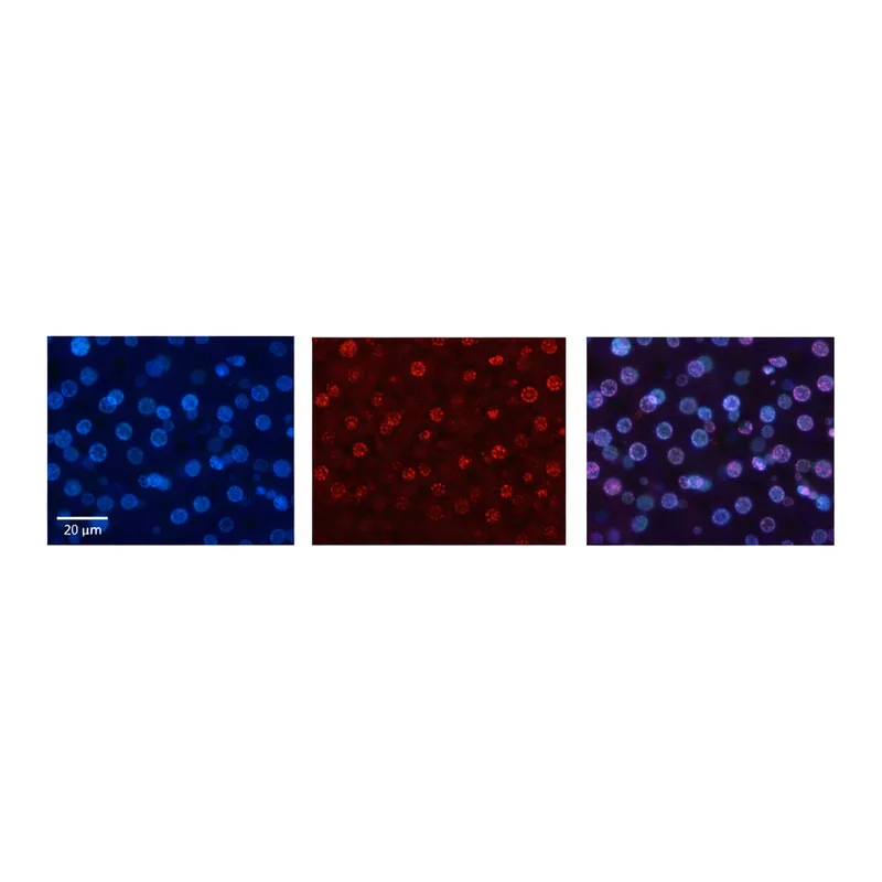 Merck Anti-RUNX1T1 antibody produced in rabbit