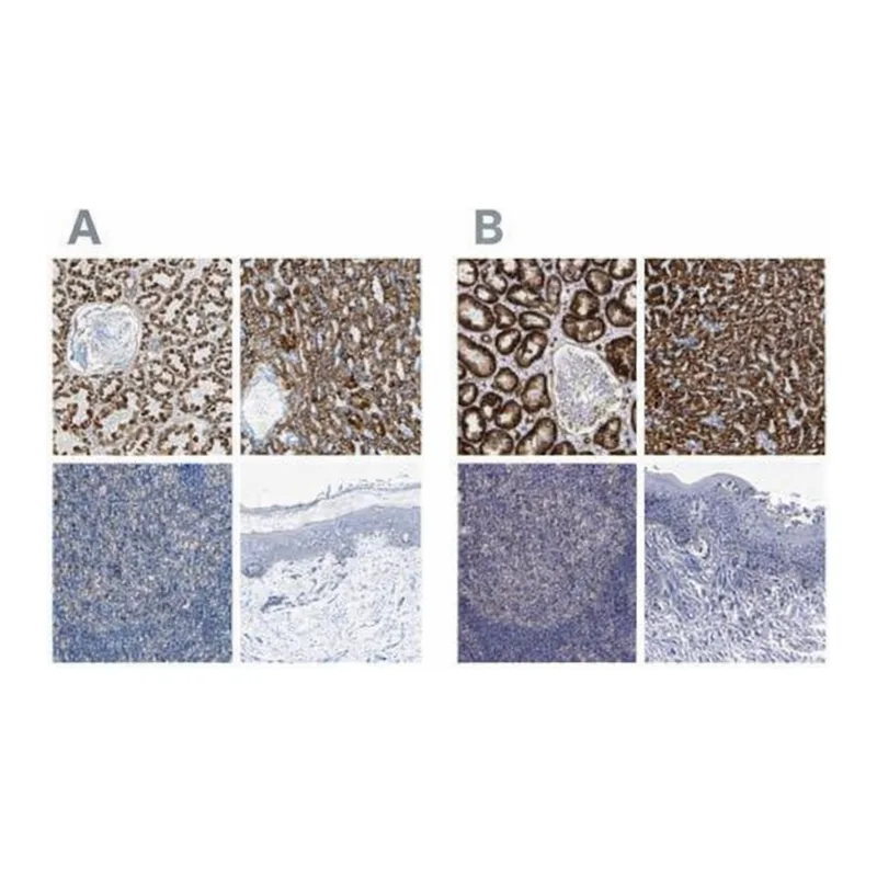 Merck Anti-ACADM antibody produced in rabbit
