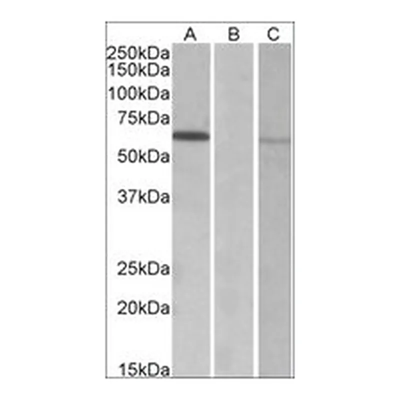 Merck ANTI-MKRN1