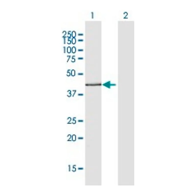Merck Anti-ADIPOR2 antibody produced in rabbit