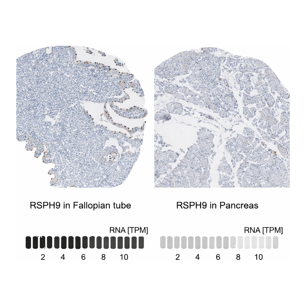 Merck Anti-RSPH9 antibody produced in rabbit