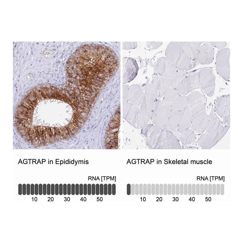 Merck Anti-AGTRAP antibody produced in rabbit
