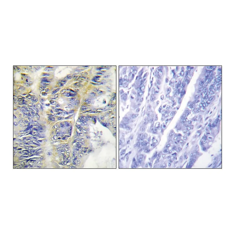 Merck Anti-Collagen IV alpha5 antibody produced in rabbit