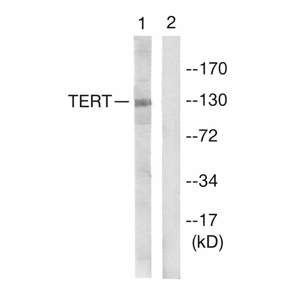 Merck ANTI-TELOMERASE