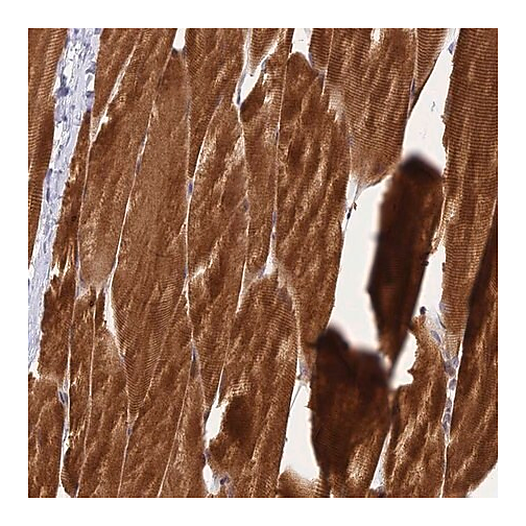 Merck Anti-PIKFYVE antibody produced in rabbit
