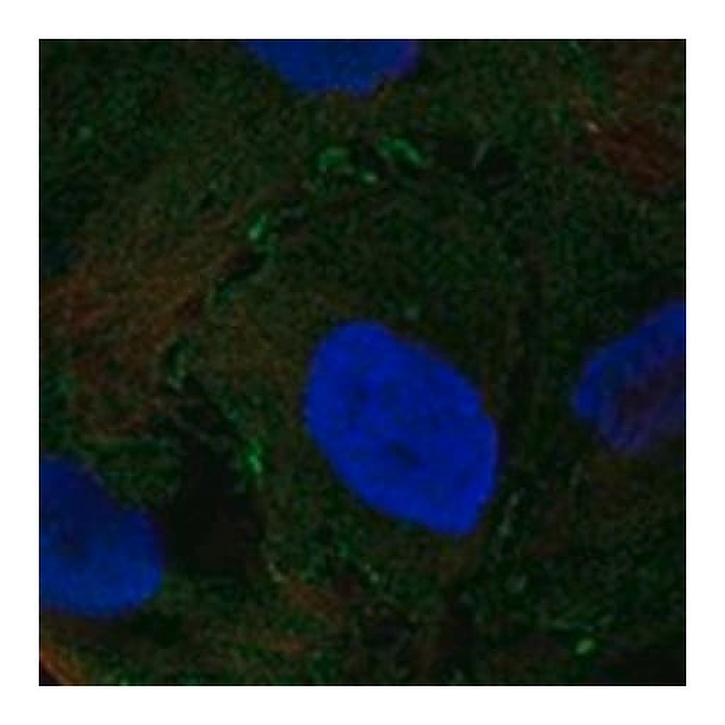 Merck Anti-NMUR2 antibody produced in rabbit