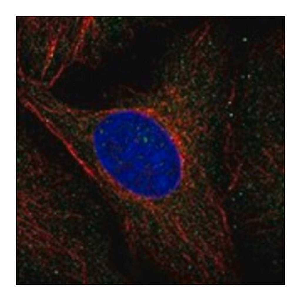 Merck Anti-MVK antibody produced in rabbit