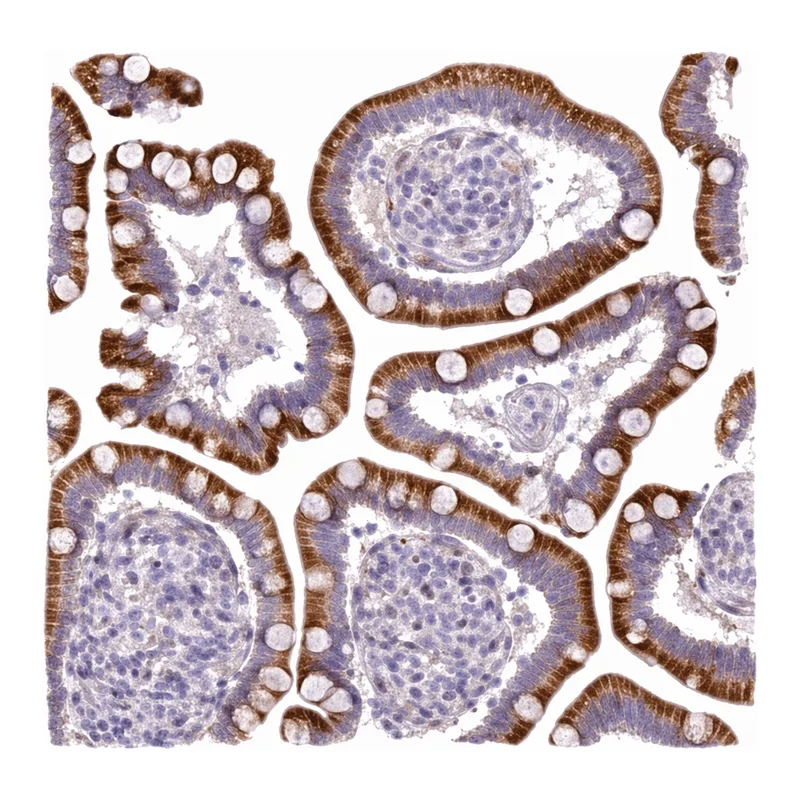 Merck Anti-KLHL3 antibody produced in rabbit