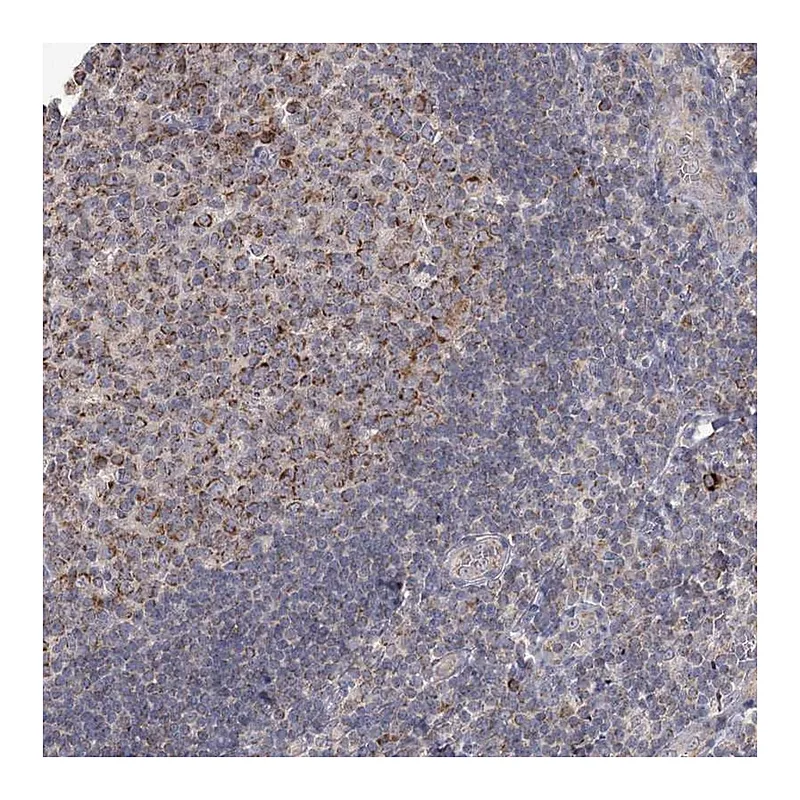 Atlas Antibodies Anti-MRPL44 Antibody