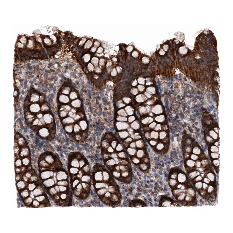 Atlas Antibodies Anti-MRPL42 Antibody