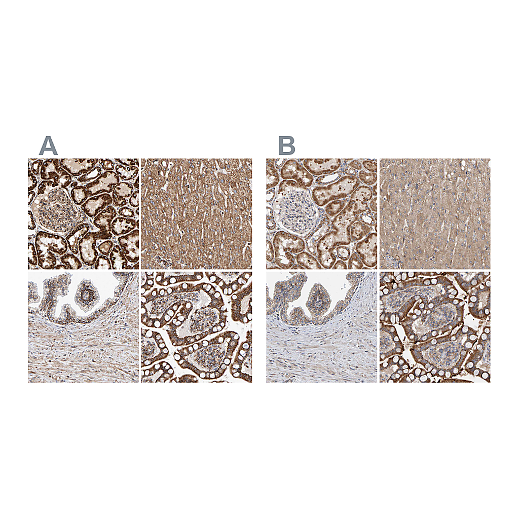 Atlas Antibodies Anti-MRPL45 Antibody