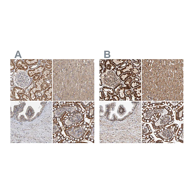 Atlas Antibodies Anti-MRPL45 Antibody