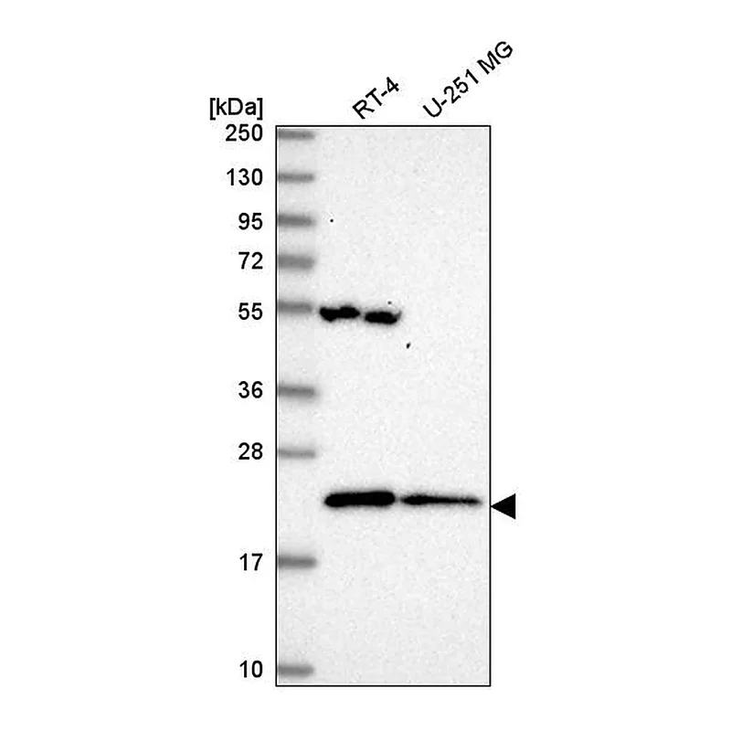 Atlas Antibodies Anti-MRPL47 Antibody