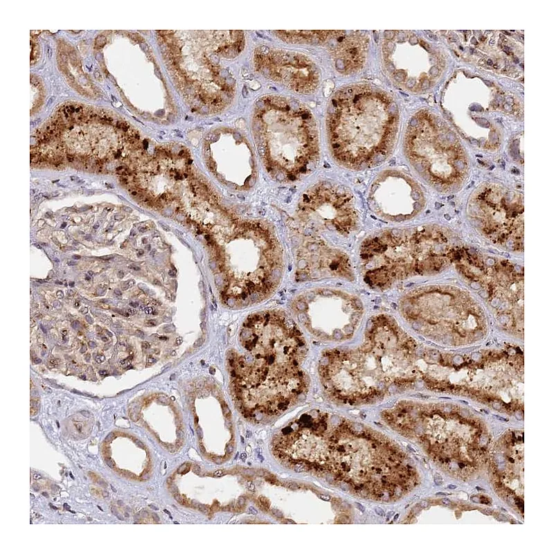 Atlas Antibodies Anti-MRPL49 Antibody