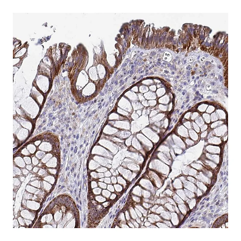 Atlas Antibodies Anti-MRPL53 Antibody