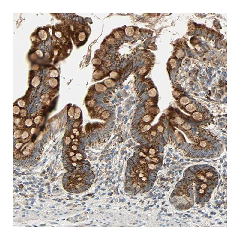 Atlas Antibodies Anti-MRPL9 Antibody