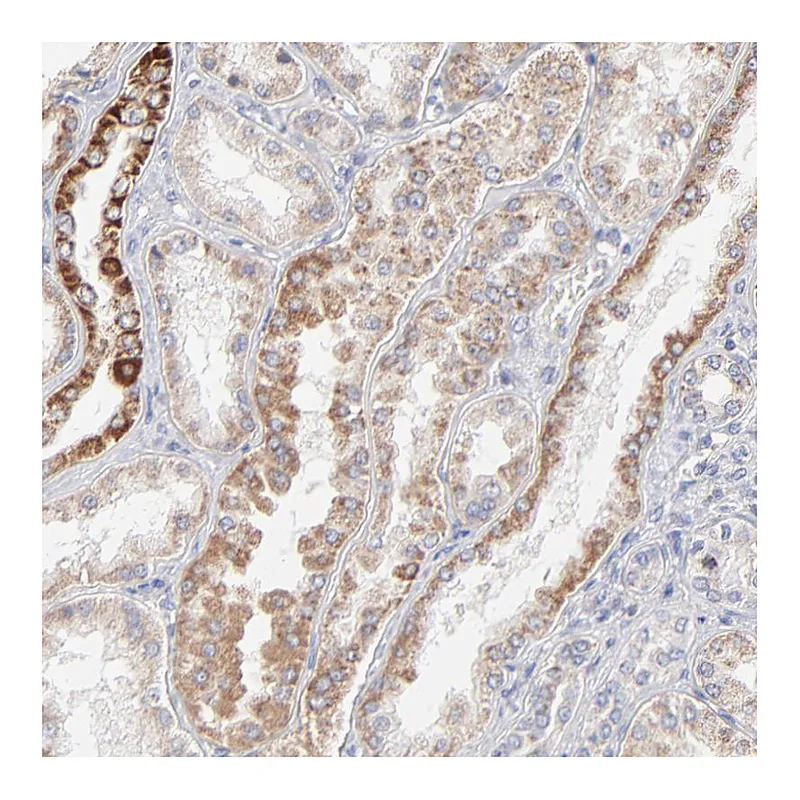 Atlas Antibodies Anti-MRPL58 Antibody
