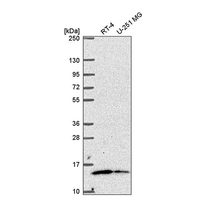 Atlas Antibodies Anti-MRPL57 Antibody