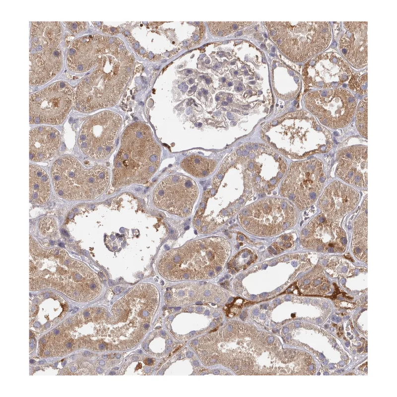 Atlas Antibodies Anti-MRPS17 Antibody