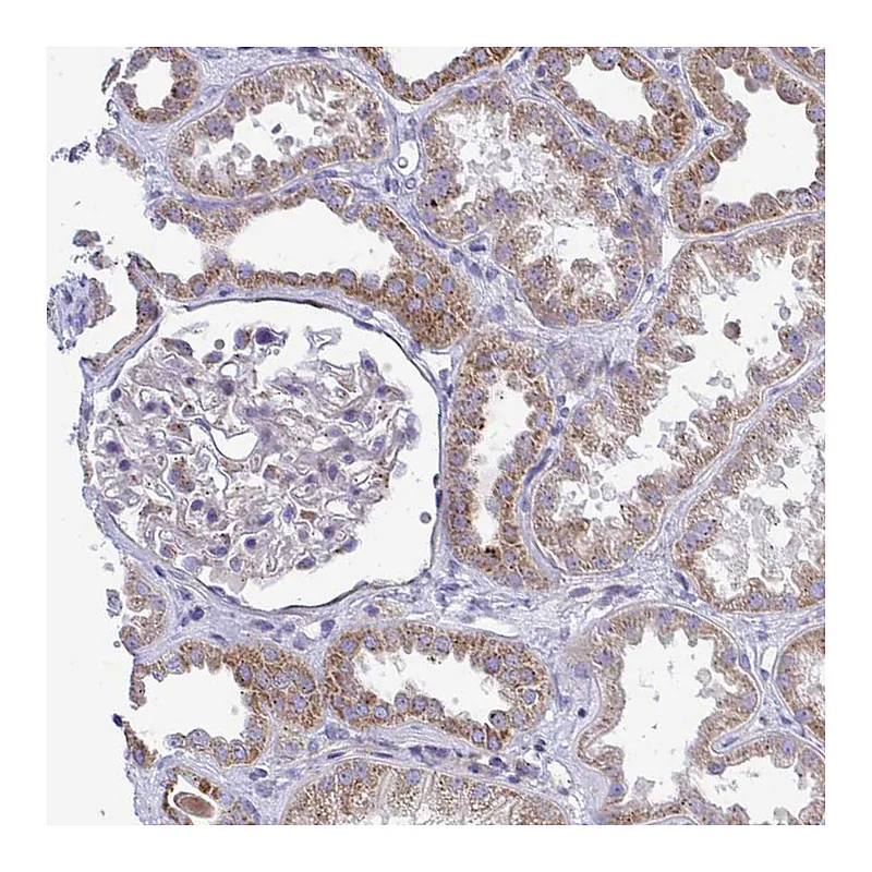 Atlas Antibodies Anti-MRPS16 Antibody