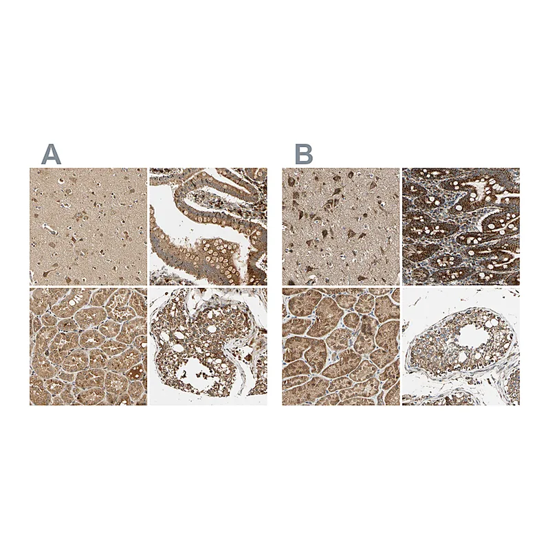 Atlas Antibodies Anti-MRPS22 Antibody