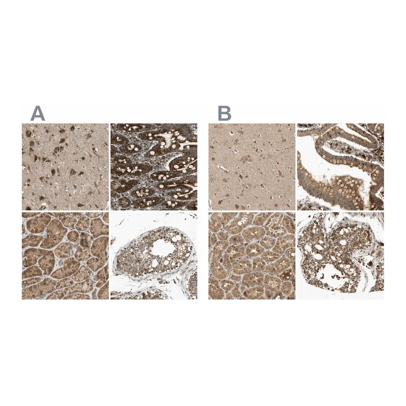 Atlas Antibodies Anti-MRPS22 Antibody